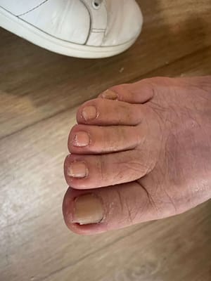 Geriatric Foot Geriatric Foot